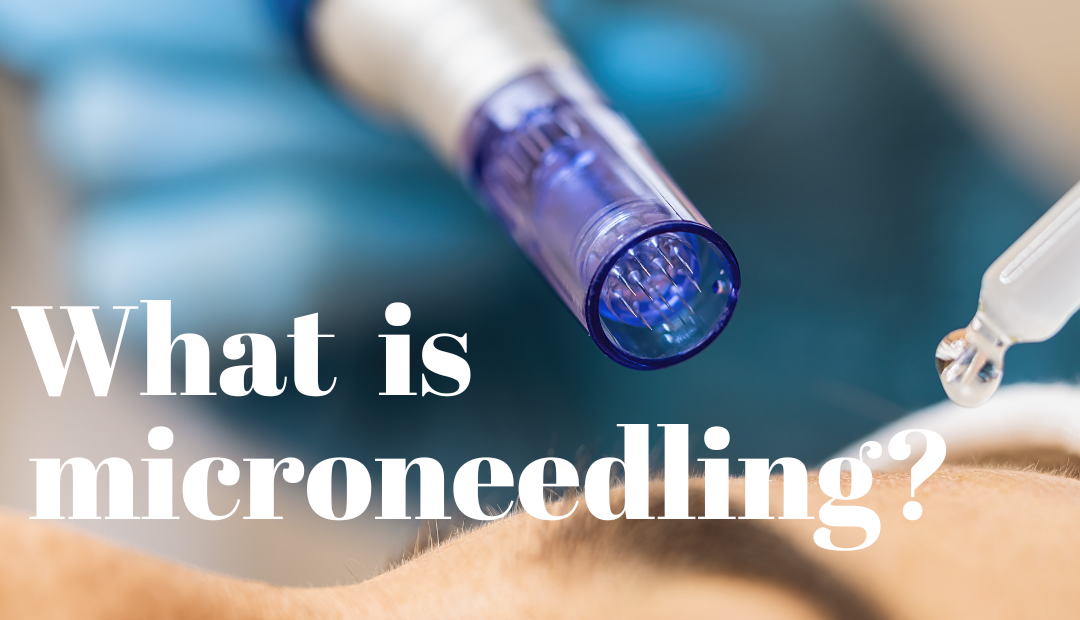 What is microneedling?