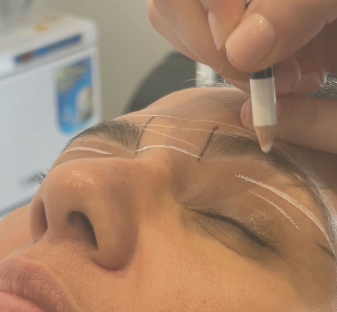 How to get a brow lift