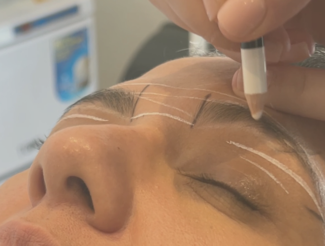 How to get a brow lift